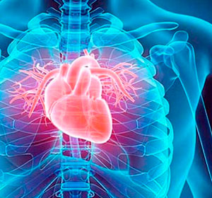 Cardiologia Intervencionista